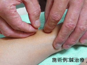 施術例